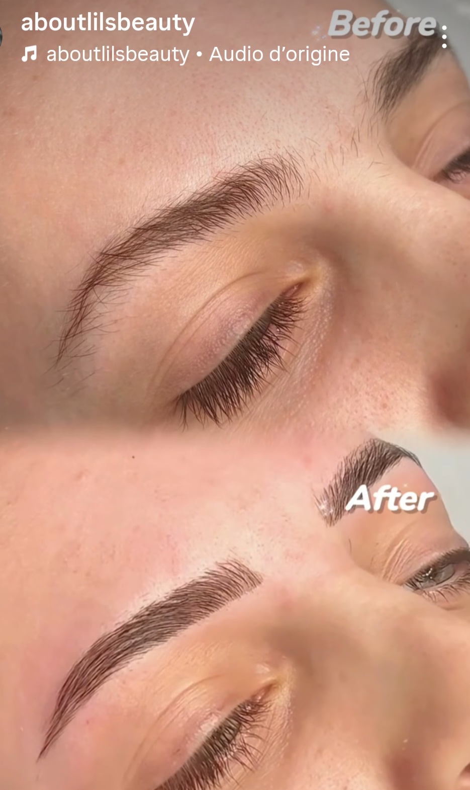 Brow Lift avec teinture, avant et après